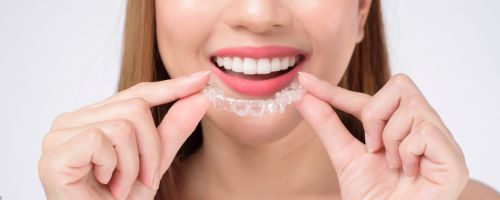 Invisalign Treatment Adelaide Invisalign Treatment Adelaide
